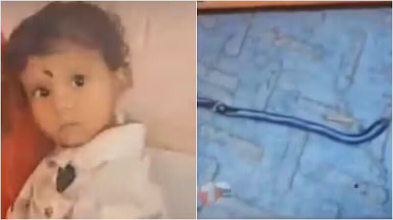 Snake Bite by Child in Bihar